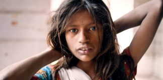 Suspen disse a pellen tesque dui