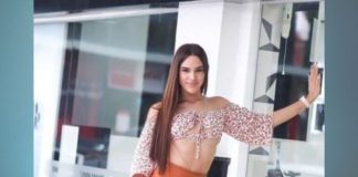 La Comadre muestra avances de la cirugía que se realizó en las orejas